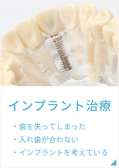 インプラント治療